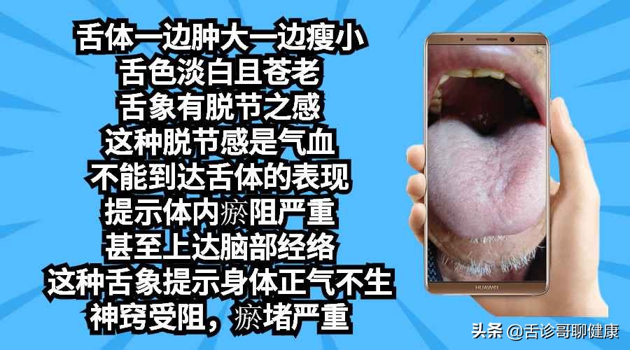 舌诊哥视频,抖音舌诊哥的感悟