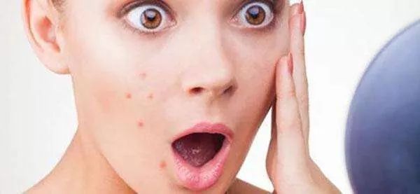 被晒伤后脱皮怎么修复,晒伤皮肤有黑斑怎么恢复