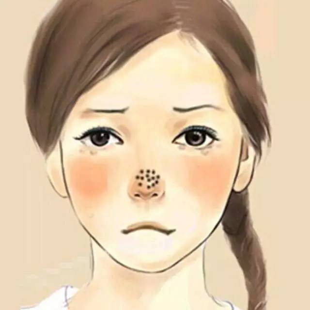 皮肤科医生建议去黑头的方法,皮肤科医生推荐去黑头方法