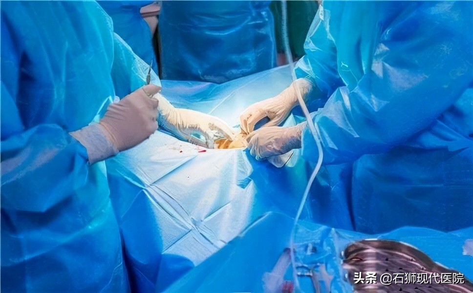 夫妻同房用力过猛致“丁丁折断”,石狮男科专家紧急手术为其修复