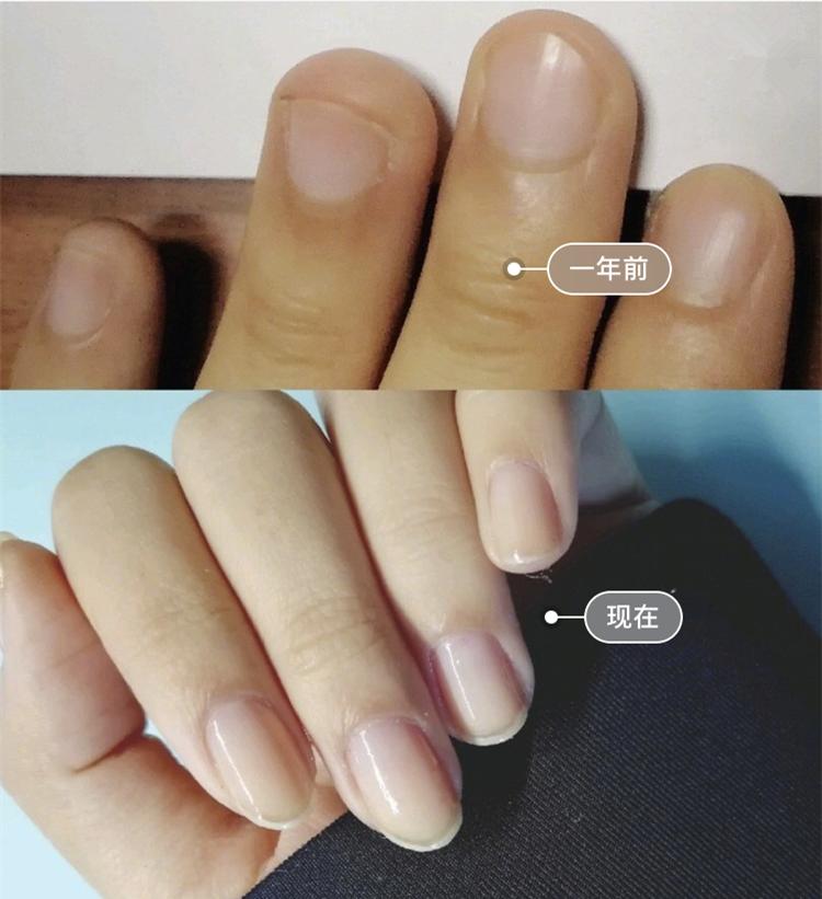 易劈易断还分层？美国专业沙龙修复甲油，给“病甲”快速“整容”