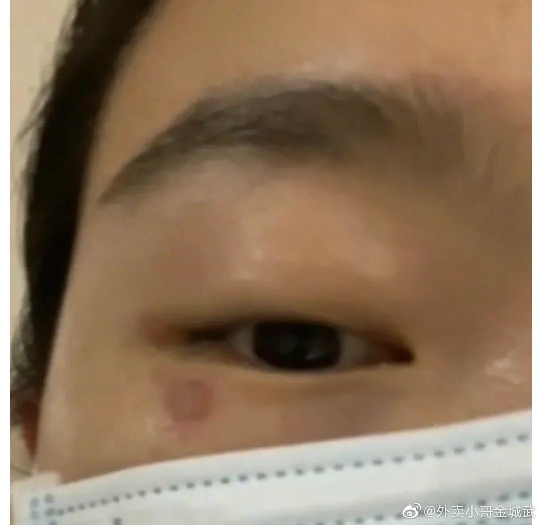 熬夜玩手机女性危害,女生熬夜玩手机导致失明