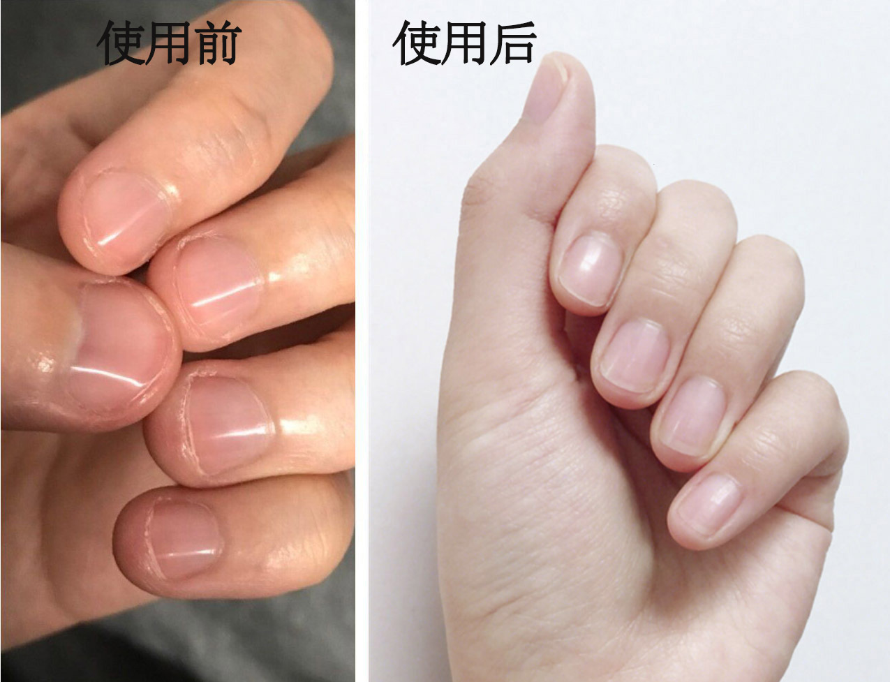 易劈易断还分层？美国专业沙龙修复甲油，给“病甲”快速“整容”