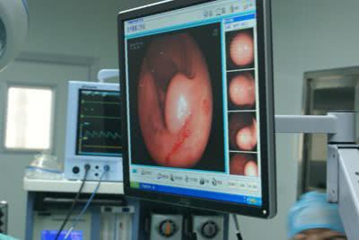 左侧腹部疼痛的主要原因有哪些,左侧腹部隐痛是什么病的预兆