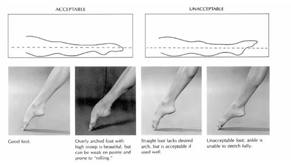 练芭蕾会导致膝超伸吗,练芭蕾舞的脚有多可怕