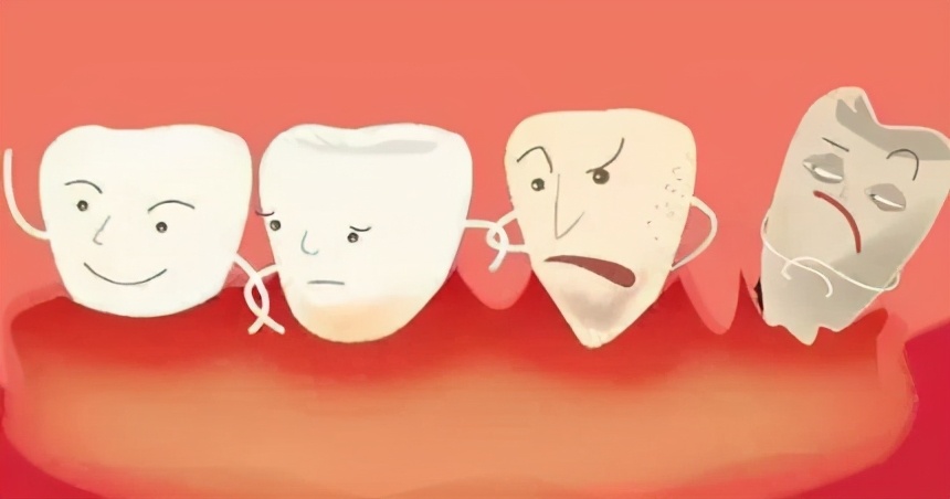 掉头发虽不美观却让你看起来像个专家，但掉牙不会