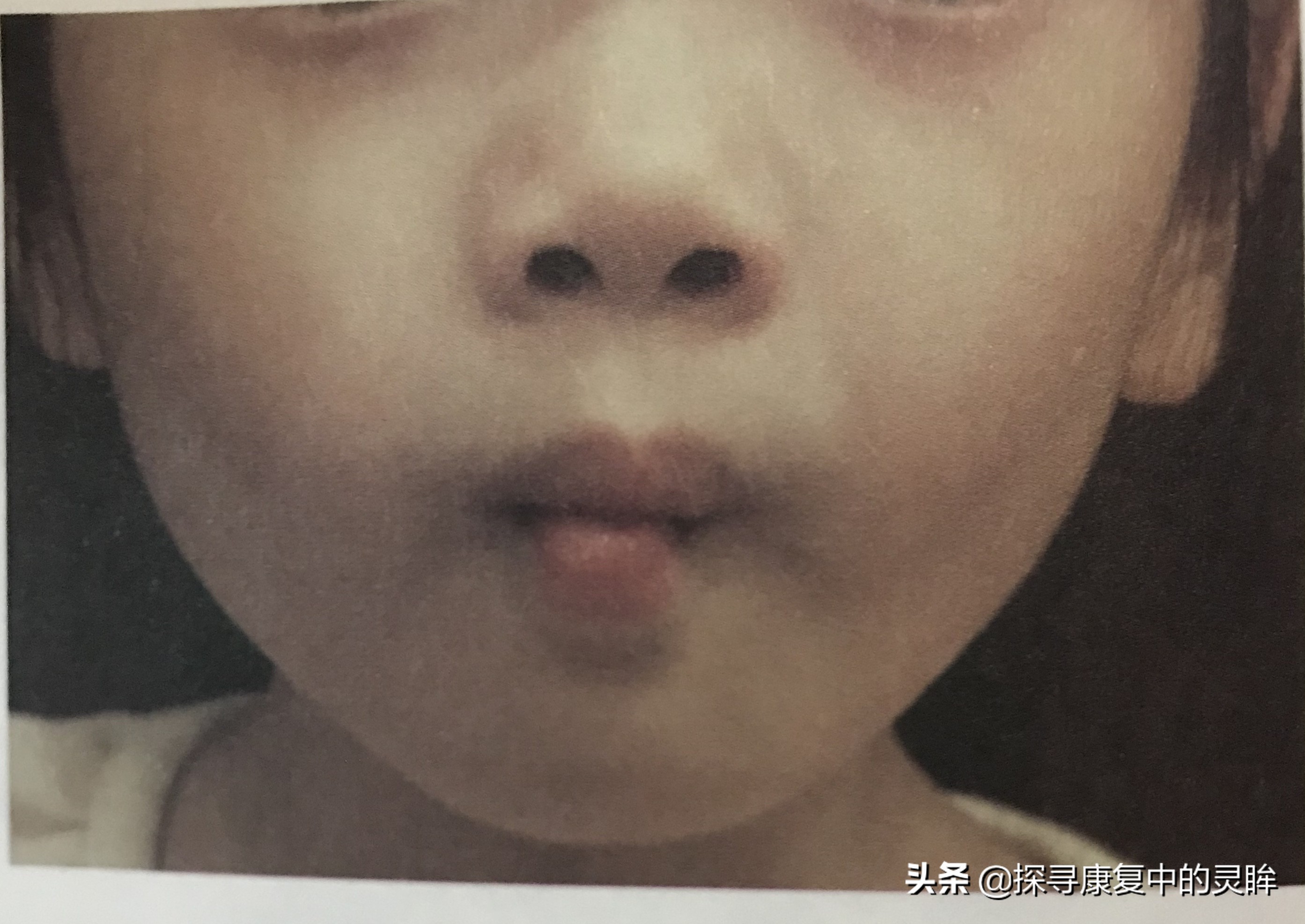 五种口部运动：灵活孩子的樱桃小嘴，让他们说话更清晰（超简单）