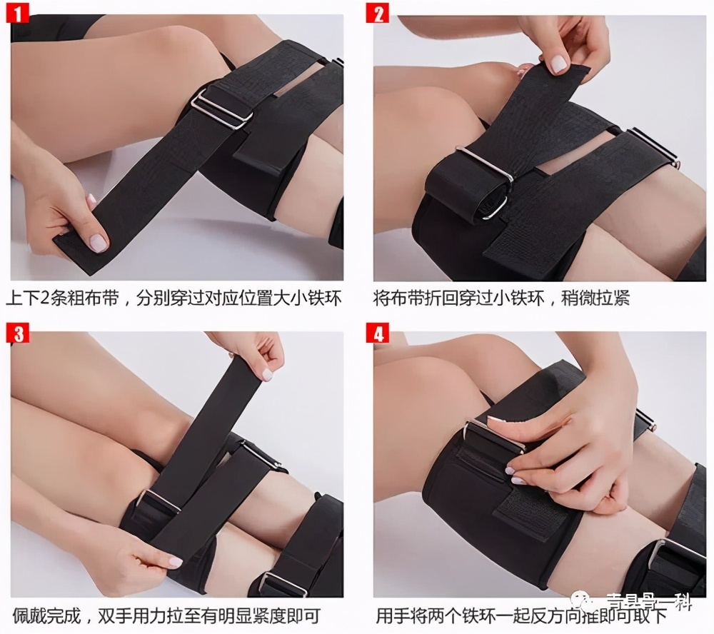 o型腿绑腿真的能矫正吗,o型腿绑腿能矫正过来吗