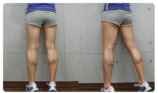 跑步一年小腿变化怎么样,跑步一天后腿变粗的原因