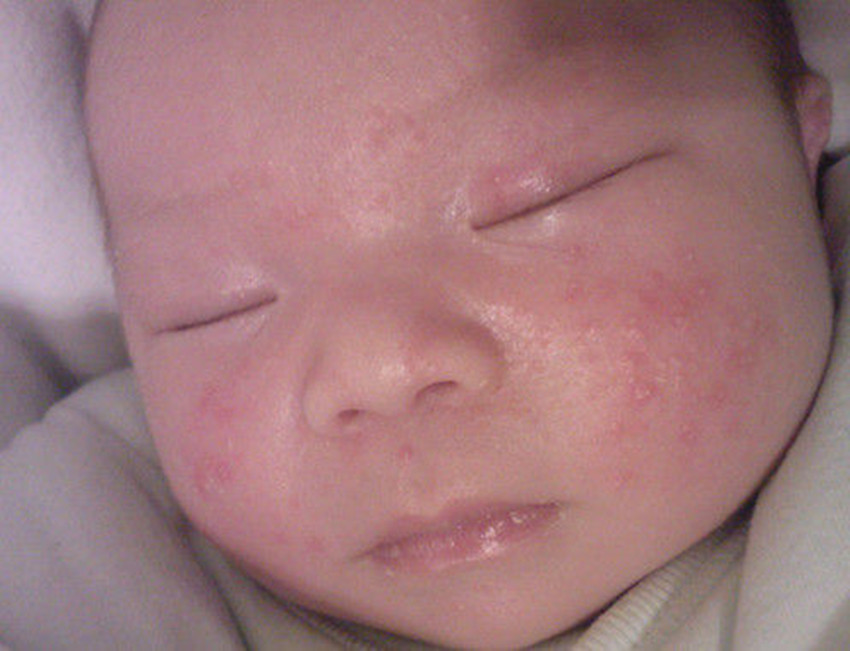 新生儿如何进行皮肤护理,新生儿皮肤常见问题照护与清洁