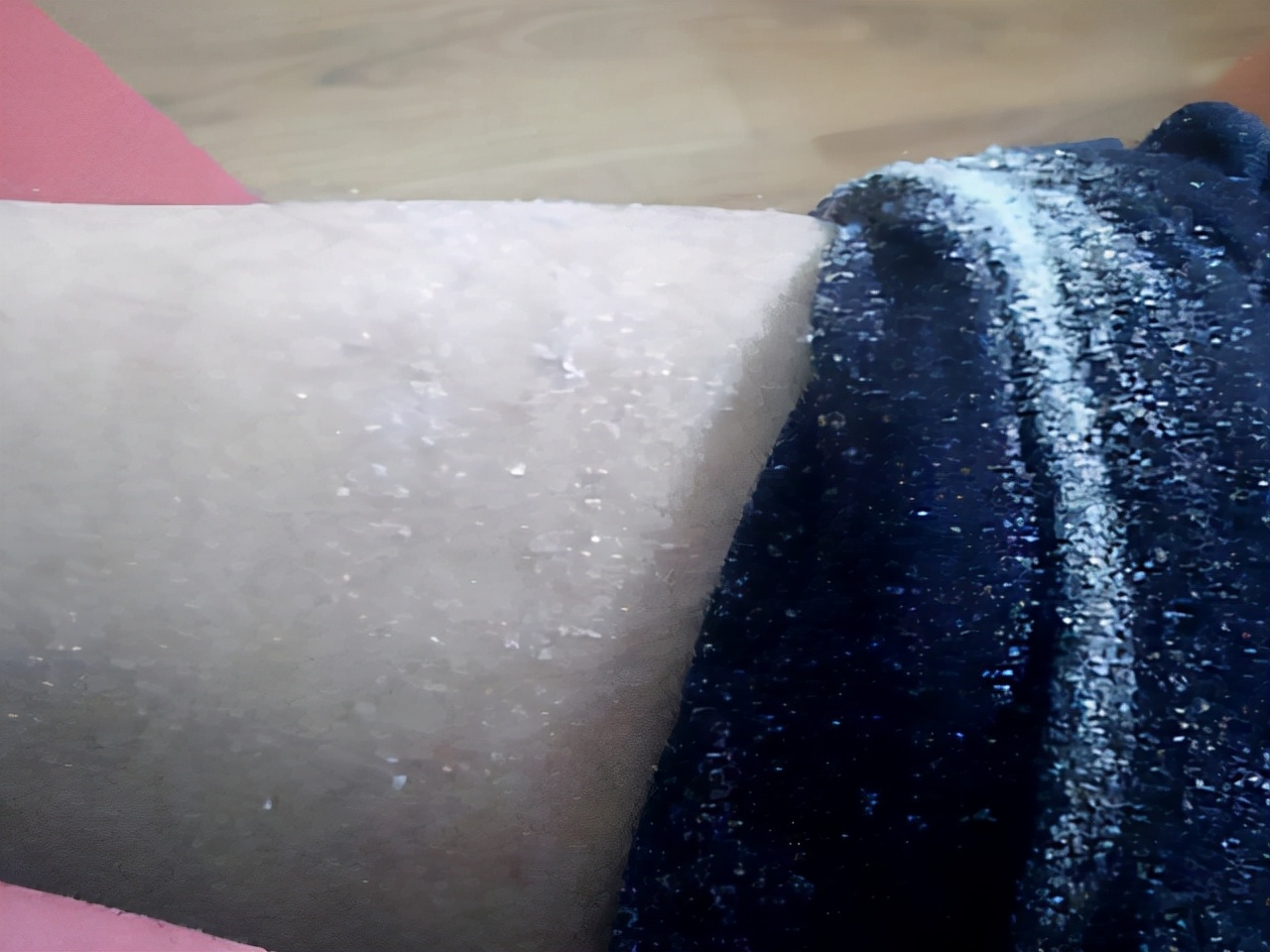 一到冬天脱了裤子腿就特别痒,冬天裤子一脱里面全是皮屑