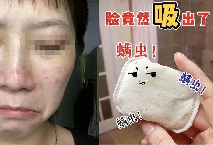 专治螨虫的洗面奶,螨虫专用洁面乳