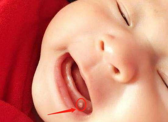 刚出生就来了月经怎么回事,刚出生生长发育