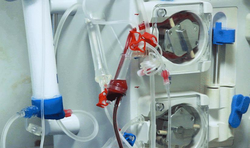 类风湿最有效的理疗方法,治类风湿用免疫吸附能调节免疫吗