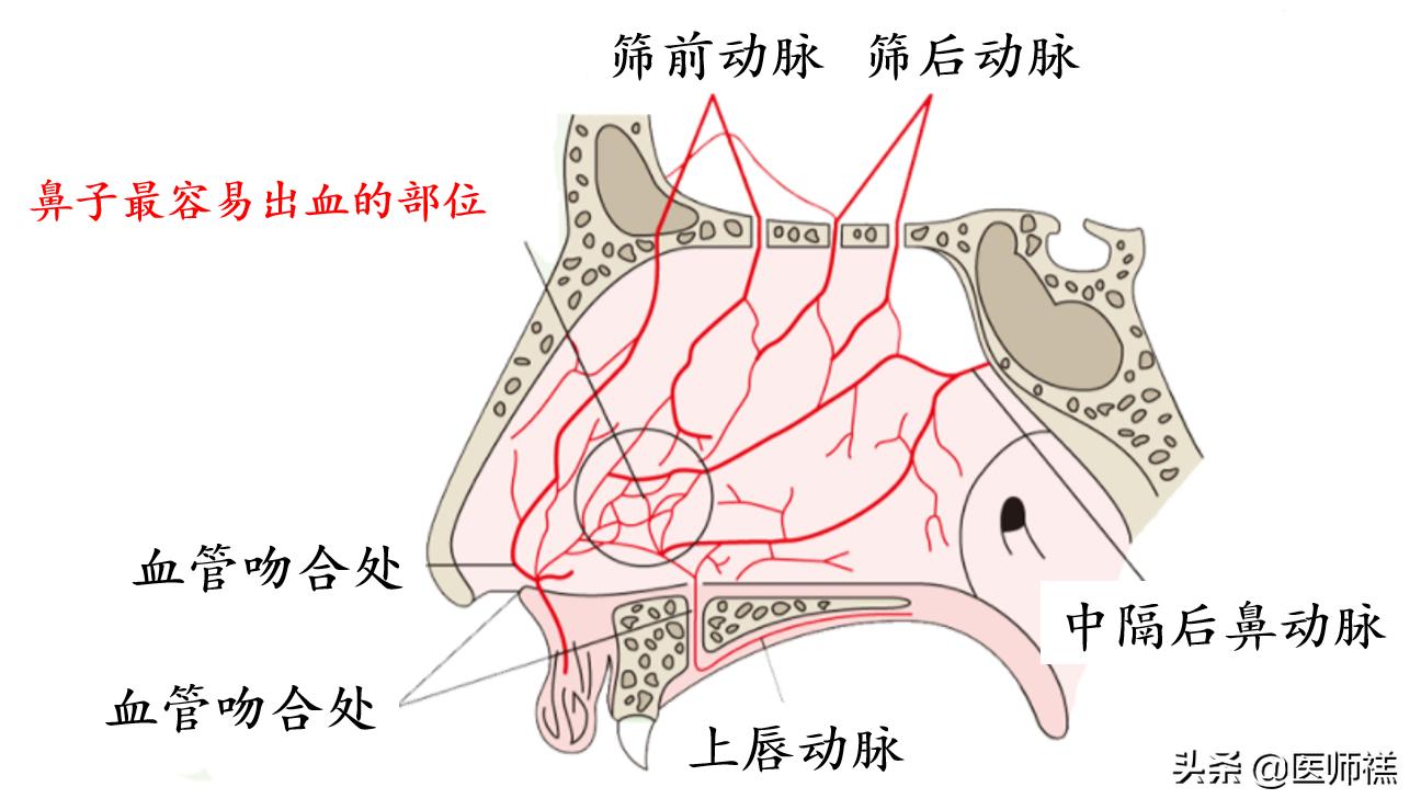 无缘无故的流鼻血是啥原因引起的,经常无缘无故流鼻血要怎么解决