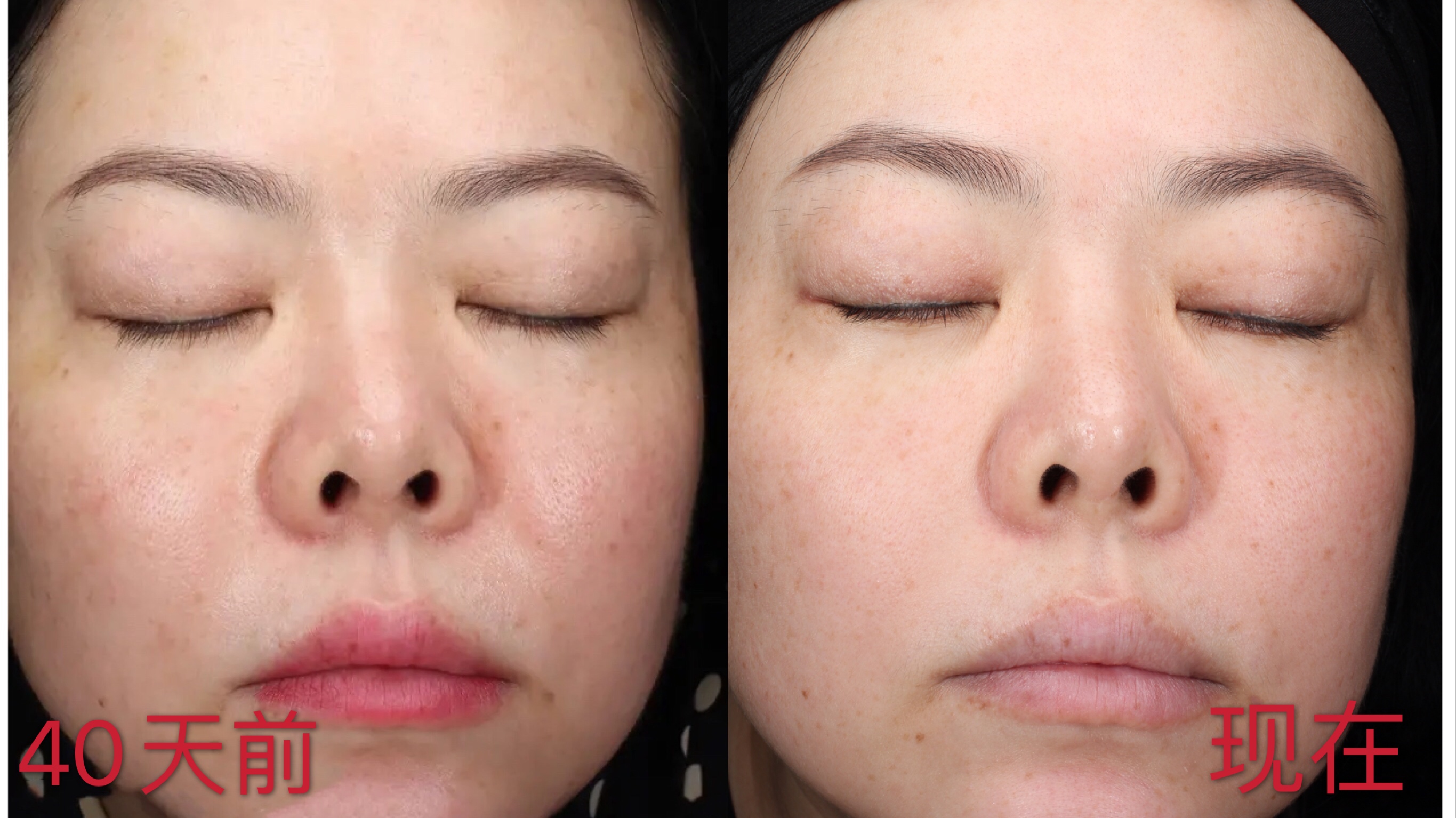 玉兰油小白瓶和olay小白瓶,sk2小灯泡和玉兰油小白瓶哪个好