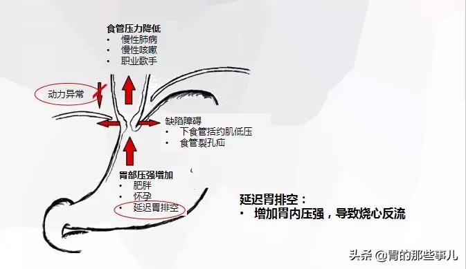 胸痛医生说不是早搏引起的,胃食管反流会引起心脏早搏吗