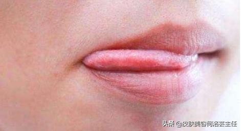 为什么早起唇色深晚上唇色浅,唇色深和唇色暗的对比