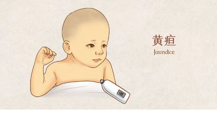 出生11天宝宝有黄疸要多喝水吗,新生儿黄疸要多喝水