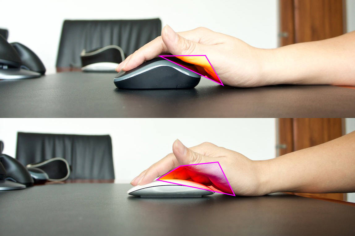 鼠标推荐防鼠标手,垂直鼠标能防鼠标手吗