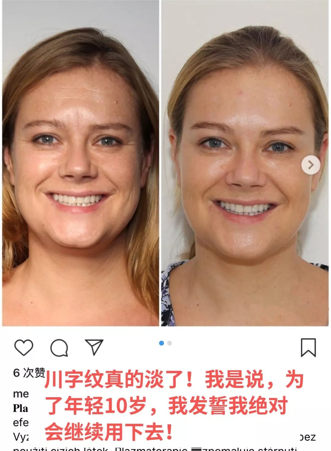 医美让女明星集体回春,女明星医美集体回春