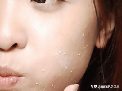 皮肤过敏和去角质有关吗,脸部过敏可以使用去角质啫喱吗