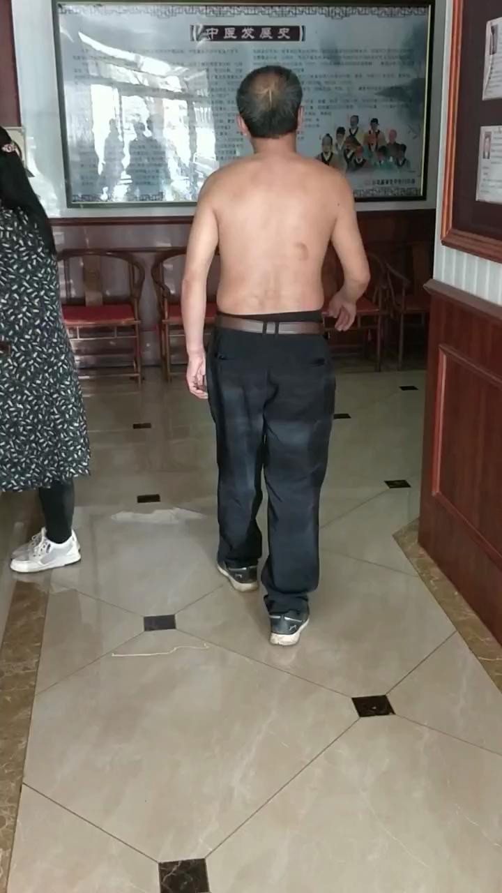 腰间盘突出没有保守治疗直接微创,腰间盘突出症不花钱自我康复疗法