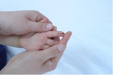 济宁推拿小儿斜颈,医院小儿推拿夜间门诊