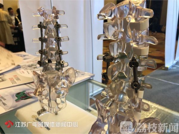 为什么人老了会腰弓驼背,人老了驼背怎样改善