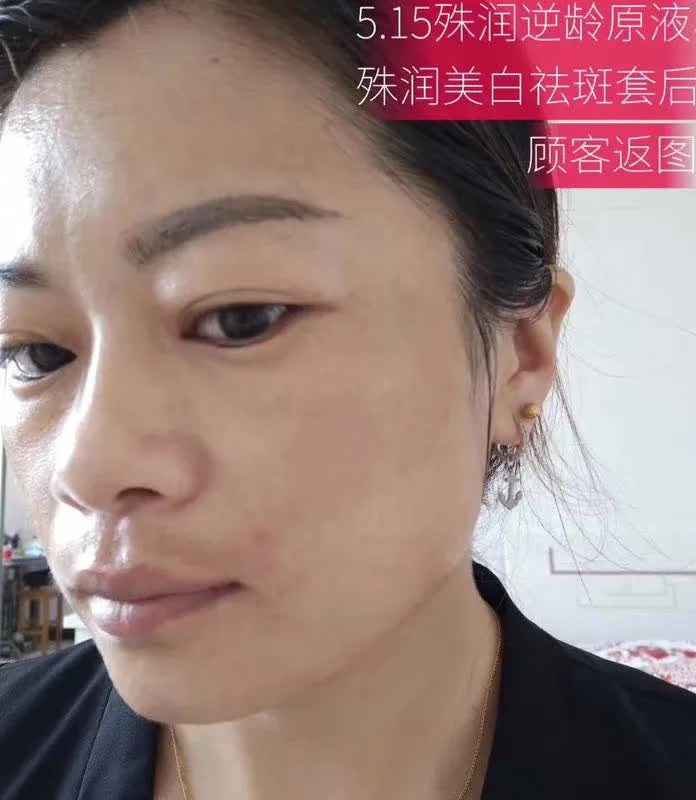 推荐好用的祛斑套盒,祛斑套盒推荐测评