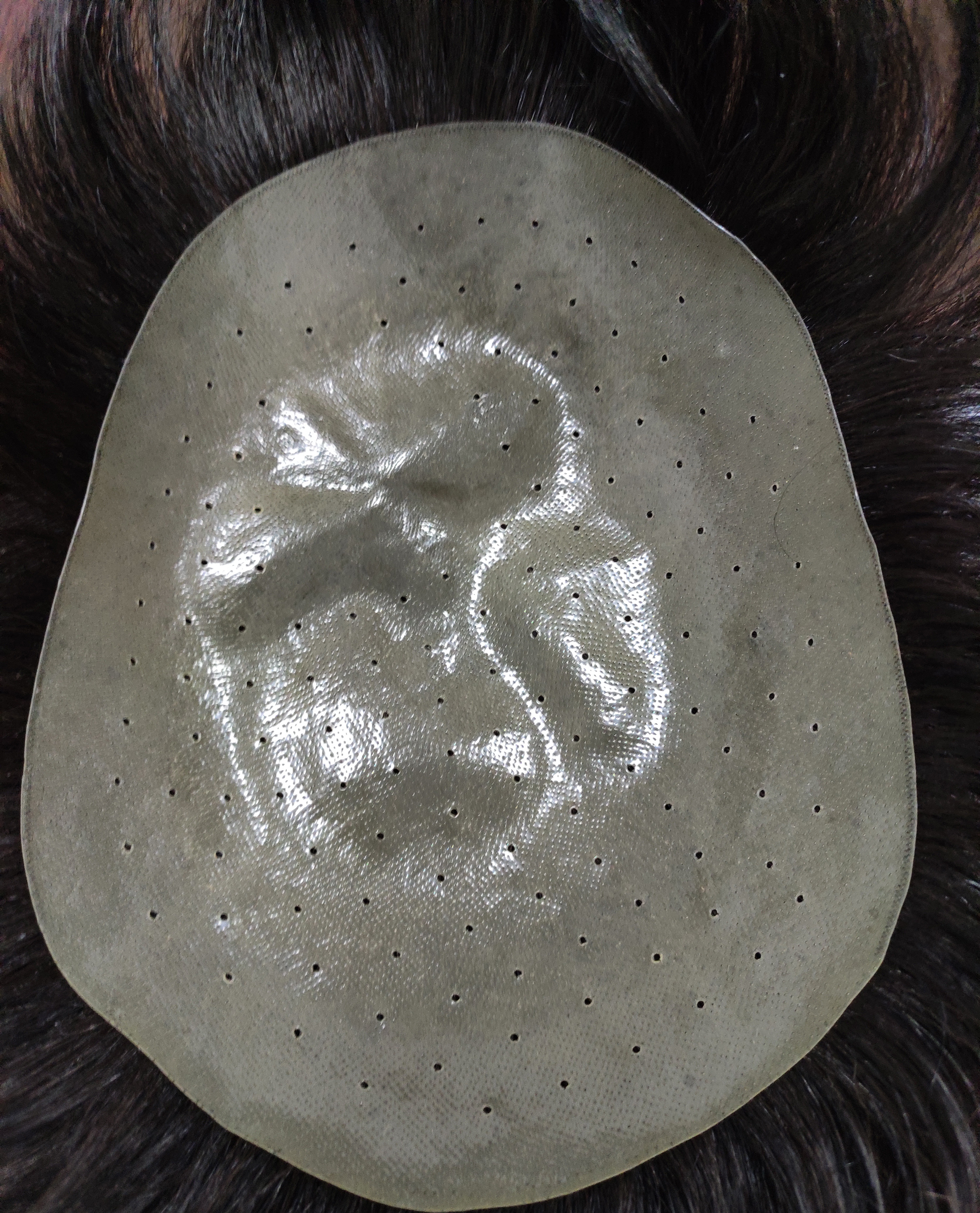 男士真发补发块真的有效果吗,瑞士网底补发片测评