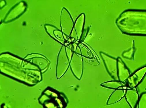 看尿酸化验单,检查尿酸600以上的图片