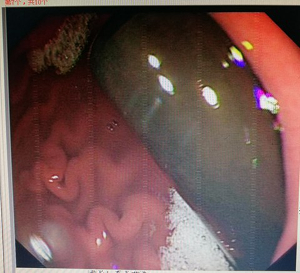 人民医院林涛医生,林涛大夫