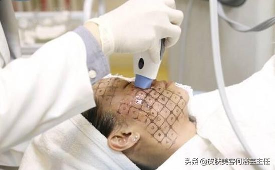 热玛吉操作时正确的手法,热玛吉医生操作时有技巧吗