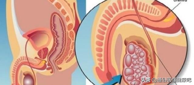 “蛋蛋”变硬？15~35岁男性最需注意的癌变预兆