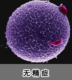 中医无精症怎么恢复生精功能,男性无精症特效配方