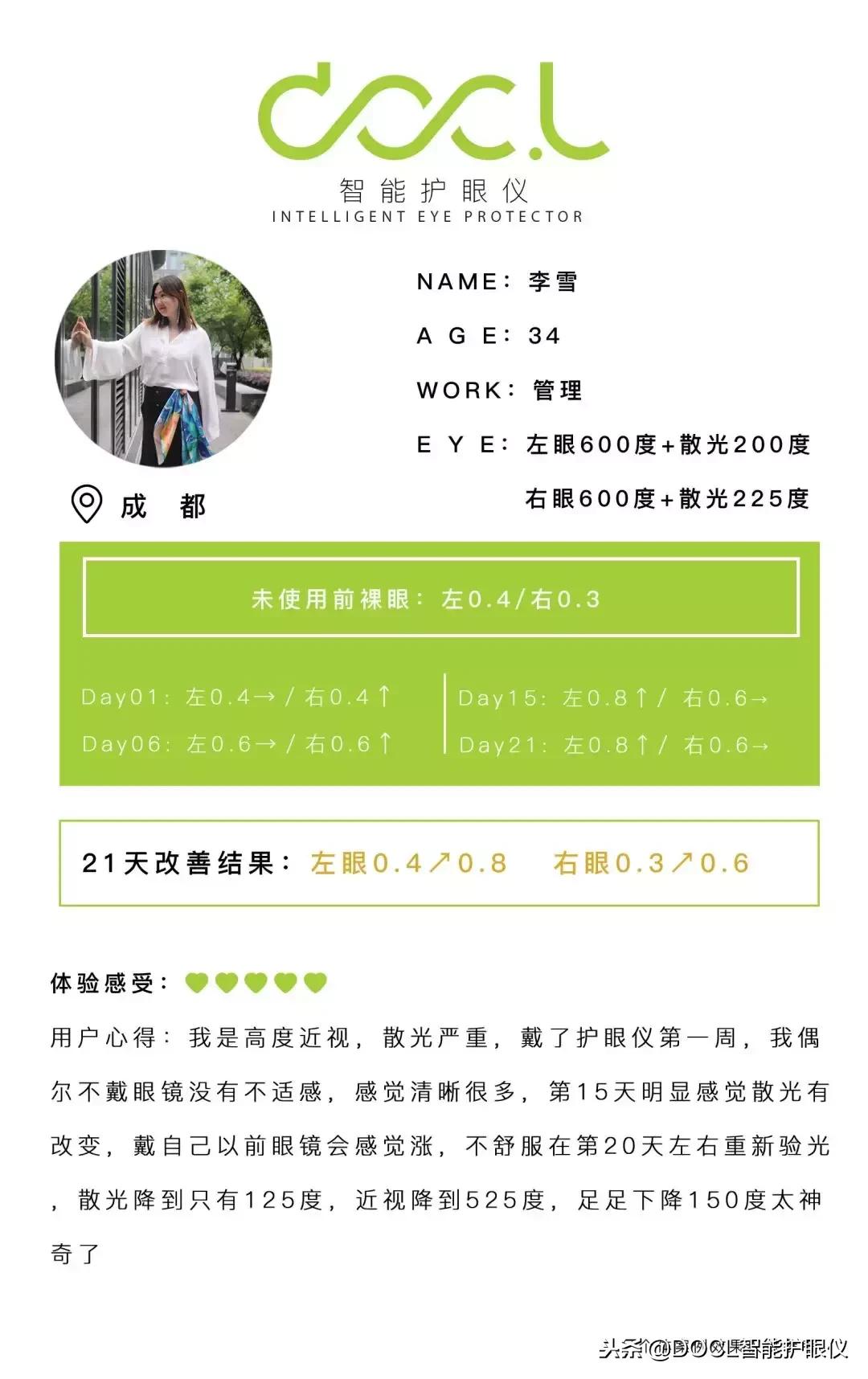 眼部按摩仪可以让眼睛变好看,改善眼部视力的仪器