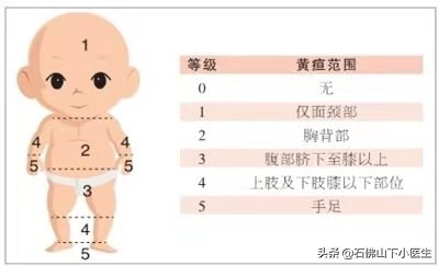 黄疸新生儿要测多久,新生儿黄疸必知