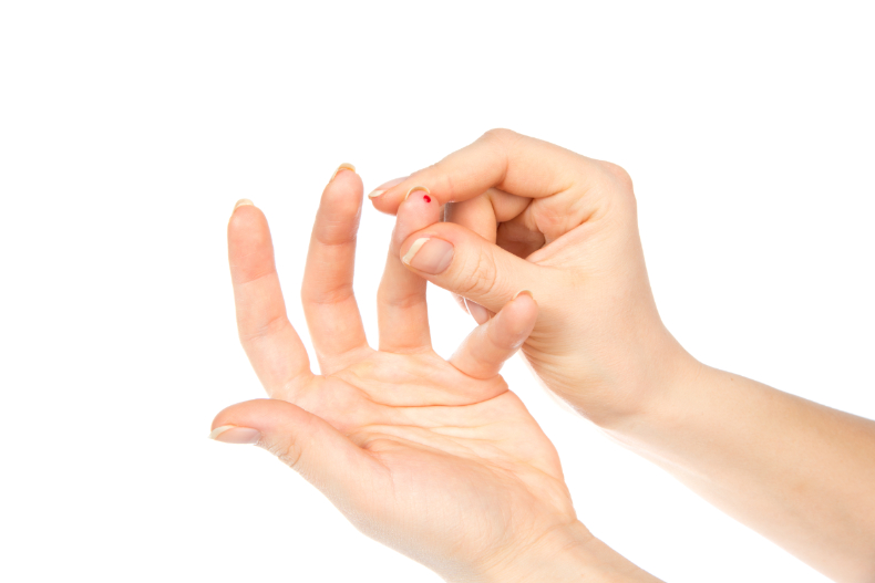 马油可以修复纹唇吗,马油能祛除旧疤痕么