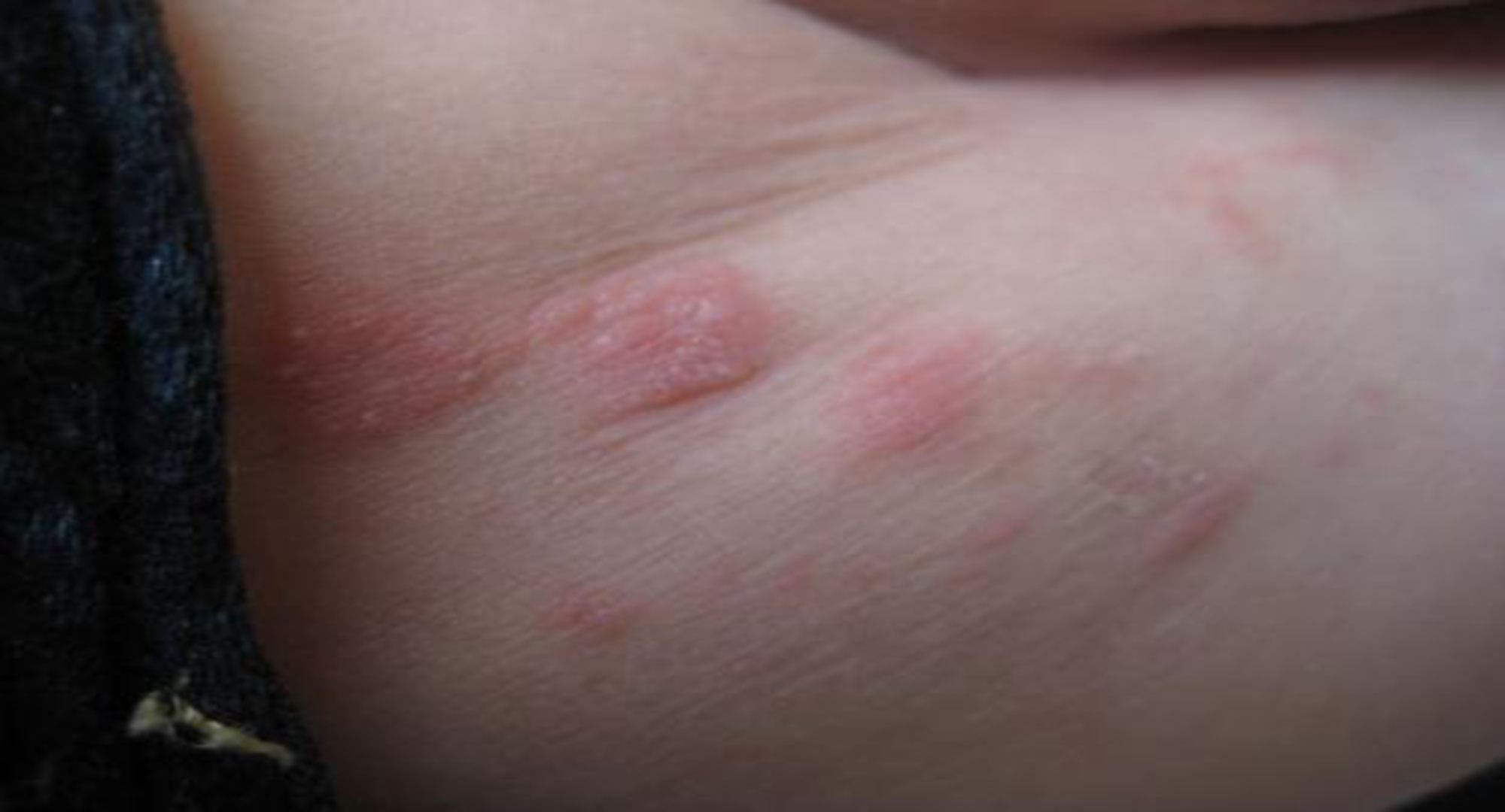 新生女宝宝能不能用爽身粉,女宝下身可以用爽身粉吗