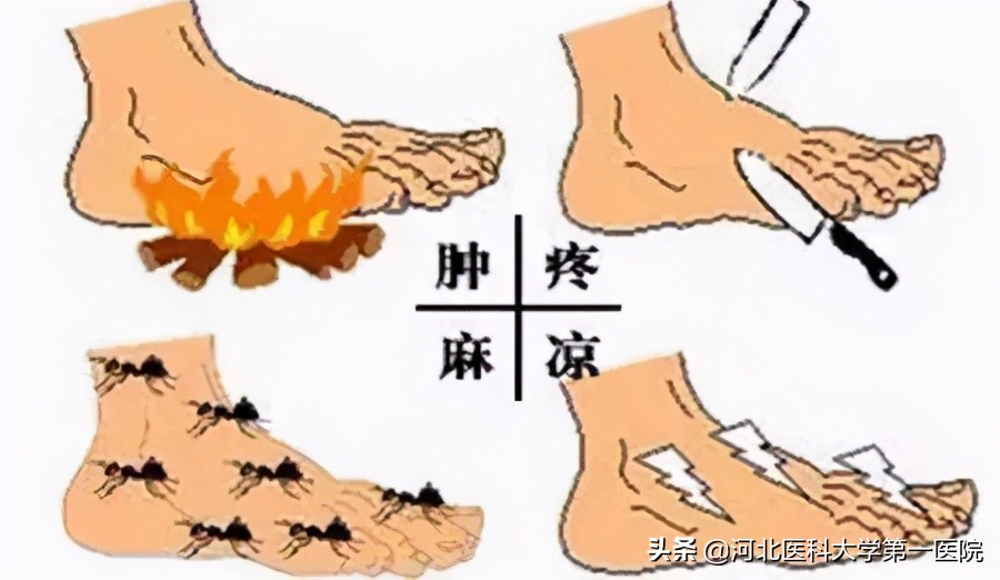 双脚肿是什么病的前兆,双脚肿疼痛是什么原因引起的