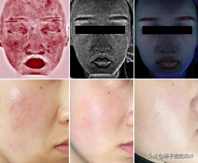 为什么天一热皮肤就痒,天一热皮肤就发红怎么办