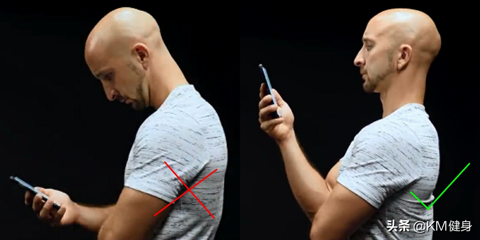 4个动作告别颈部皱纹,如何改变颈部前伸