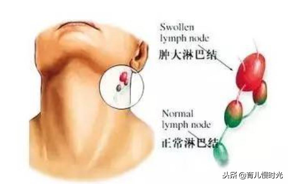 宝宝头上突然长了个硬疙瘩有点红,头上长了个软疙瘩怎么回事
