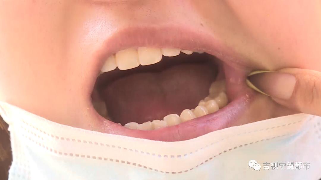 长春市超龙牙博士口腔,牙博士口腔烤瓷牙多少钱