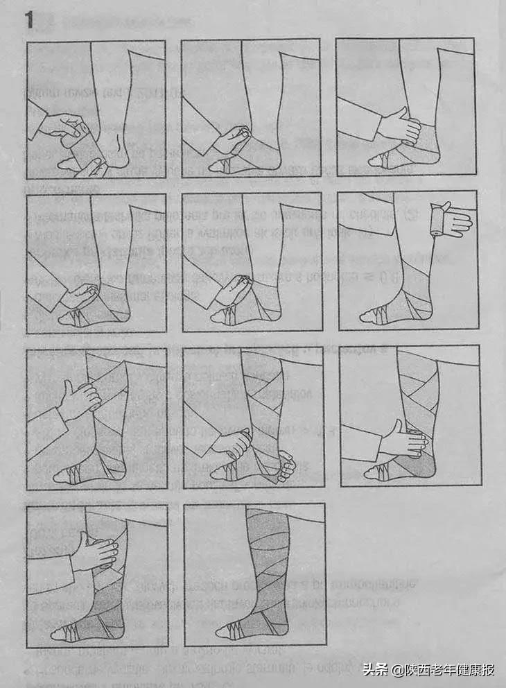 下肢静脉性溃疡伤口护理,关于下肢静脉性溃疡伤口图片