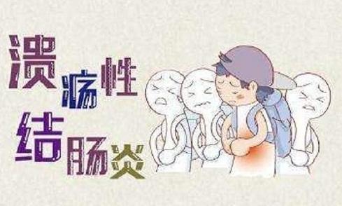 溃疡性结肠炎灌肠的药物有哪些,重度溃疡性结肠炎首选什么药物