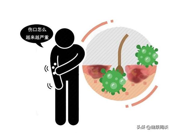 留下黑色疤痕会癌变吗,疤痕癌变的最佳治疗方法