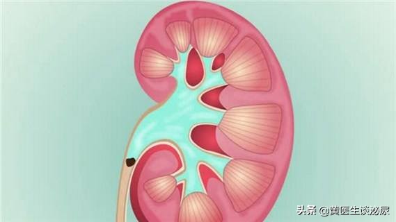 如果得了肾结石是不是必须碎石,如果得了肾结石如何治疗好