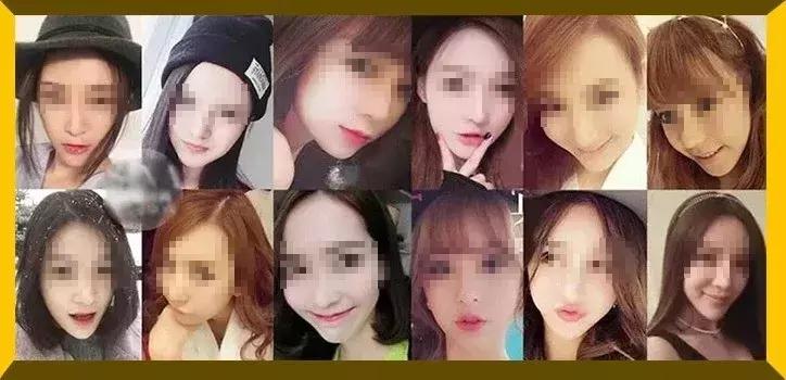 花了26万做整容手术,24岁女子花21万整容